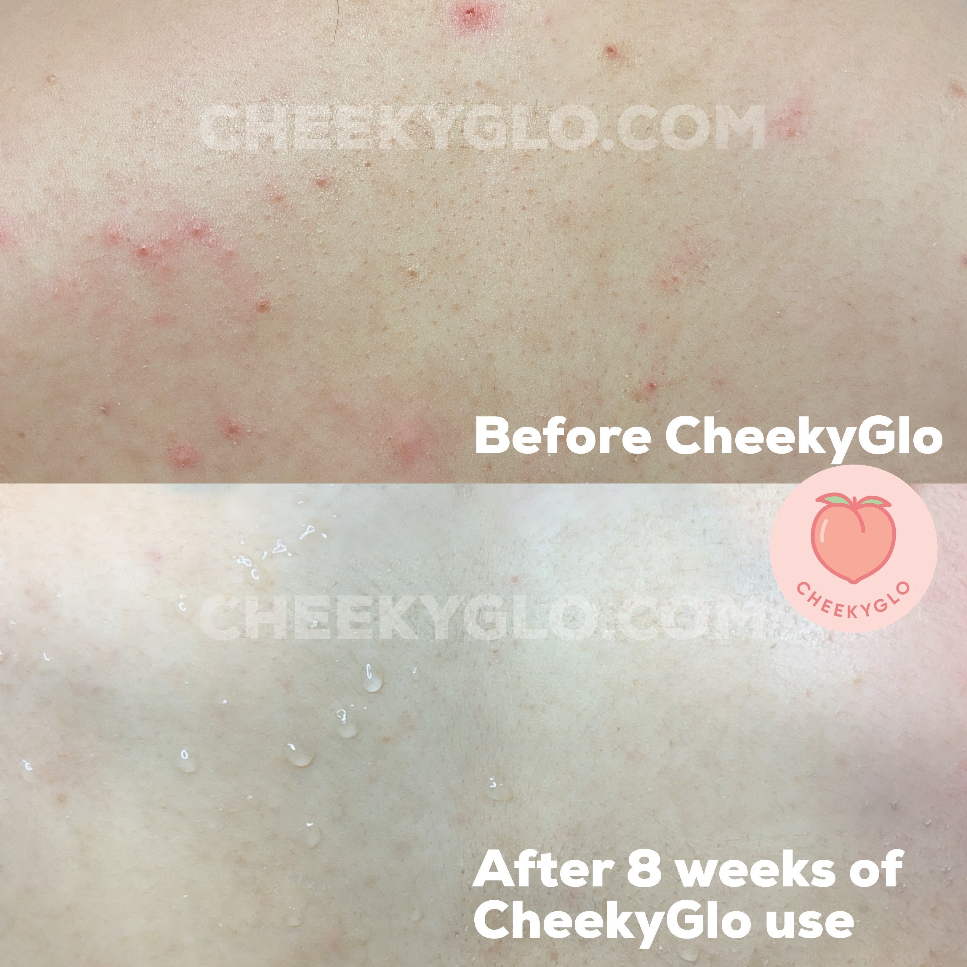 CheekyGlo Exfoliating Glove (Pink) - Cheeky Glo
