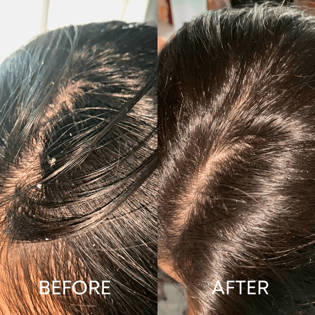 CheekyGlo Scalp Scrubber - CHEEKYGLO