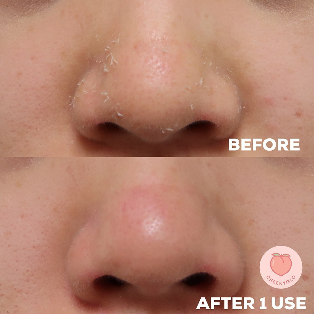CheekyGlo Silk Exfoliating Face Mitt - Cheeky Glo